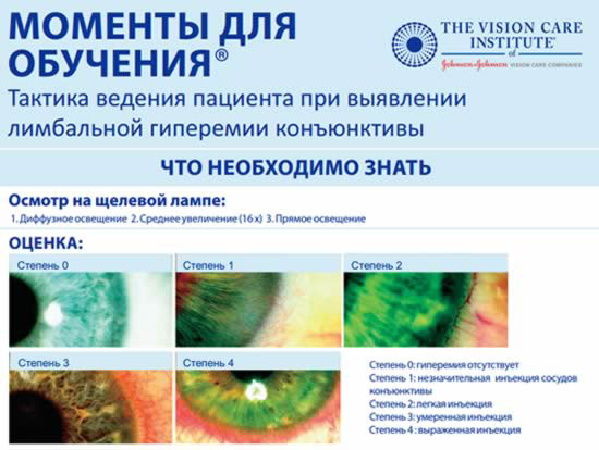Клинические аспекты контактной коррекции зрения